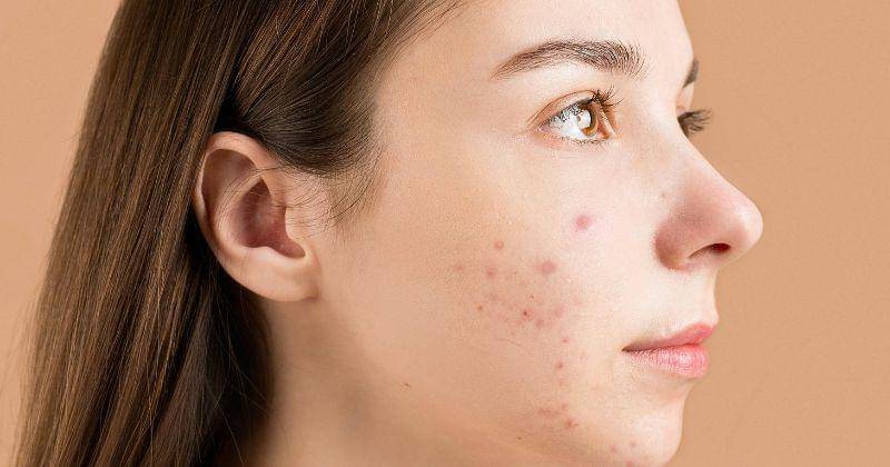 Pexels/Anna Nekrashevich